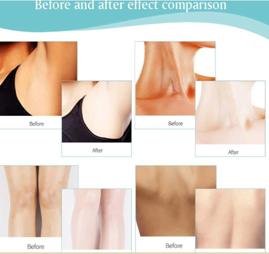 Whitening cream for body